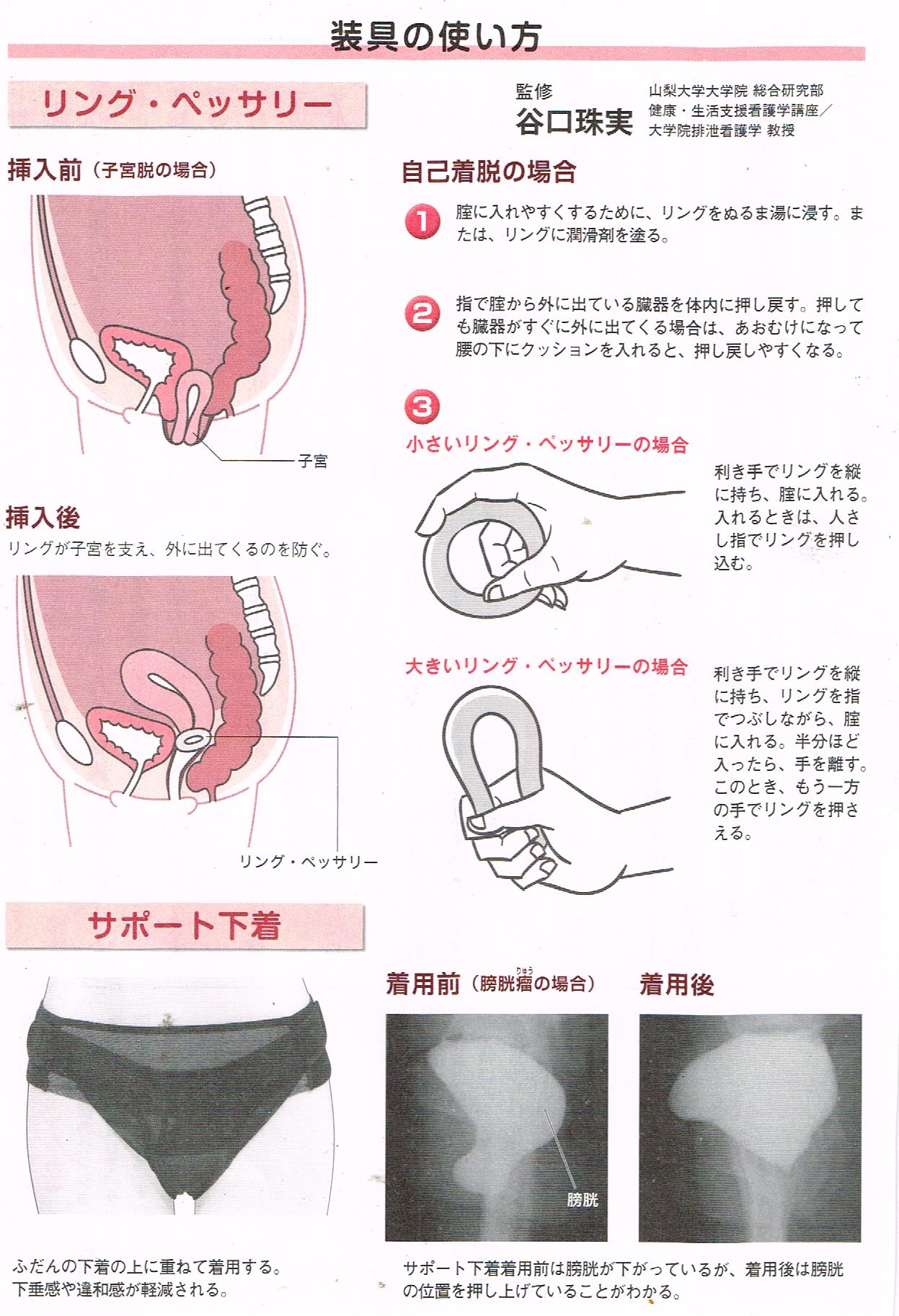 装具の使い方