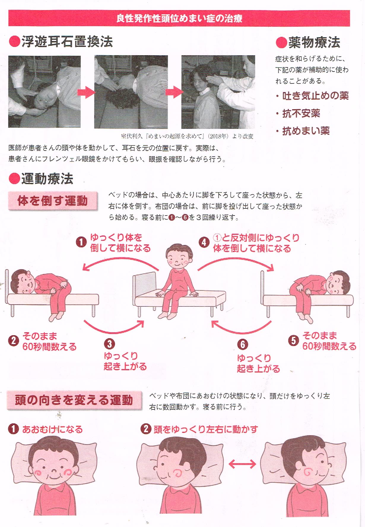 良性発作性頭位めまい症の治療