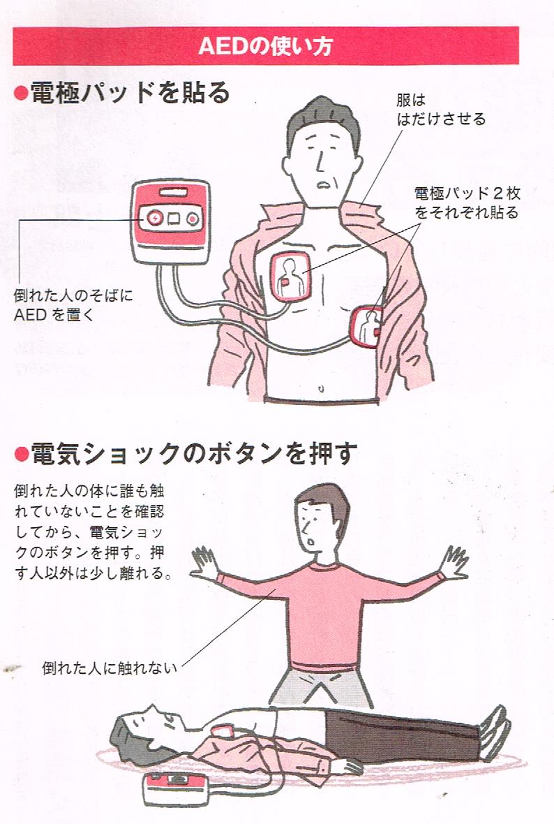 AEDの使い方