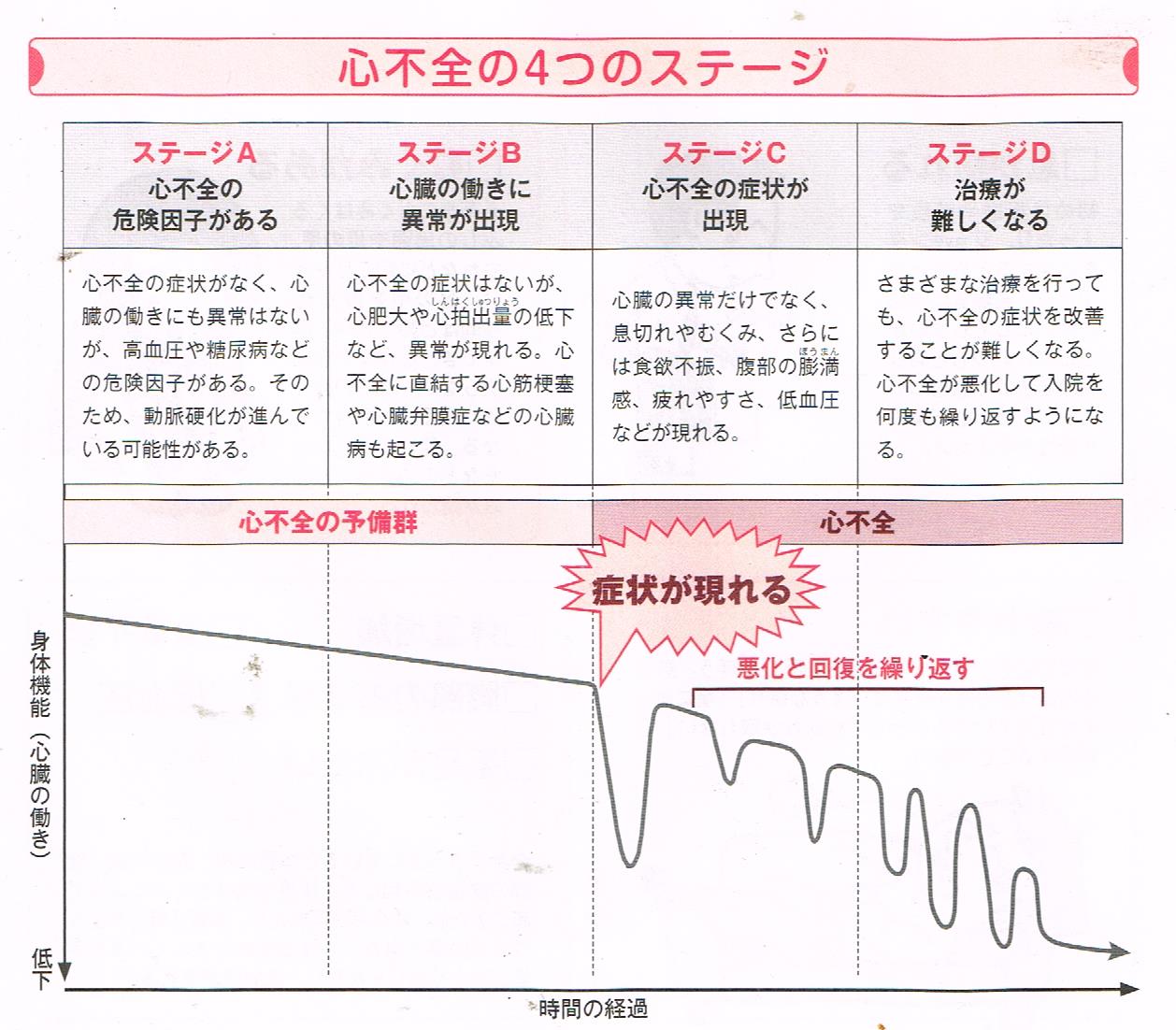 心不全の４つのステージ