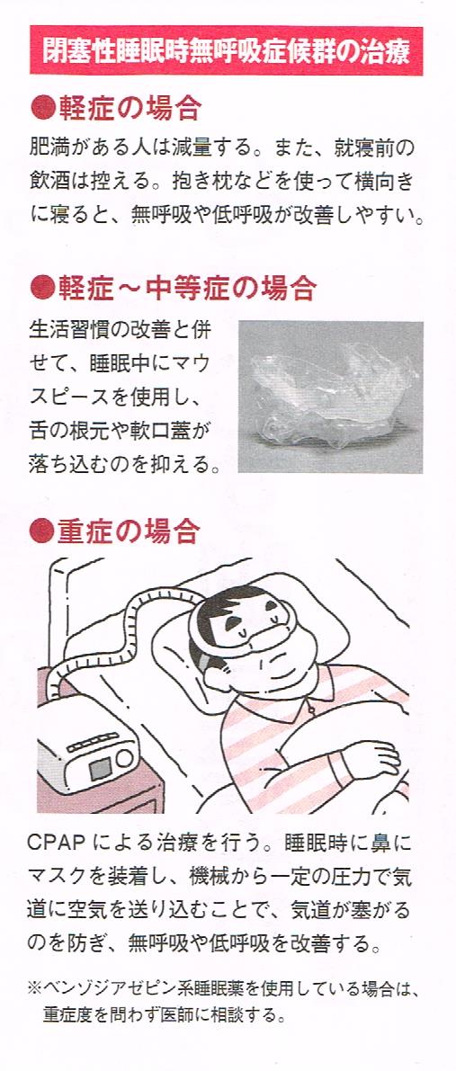 睡眠時無呼吸症候群の治療