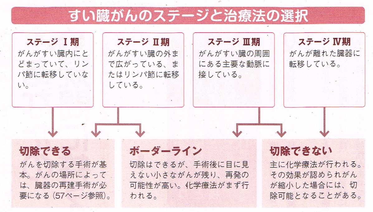 膵臓癌のステージと治療法の選択