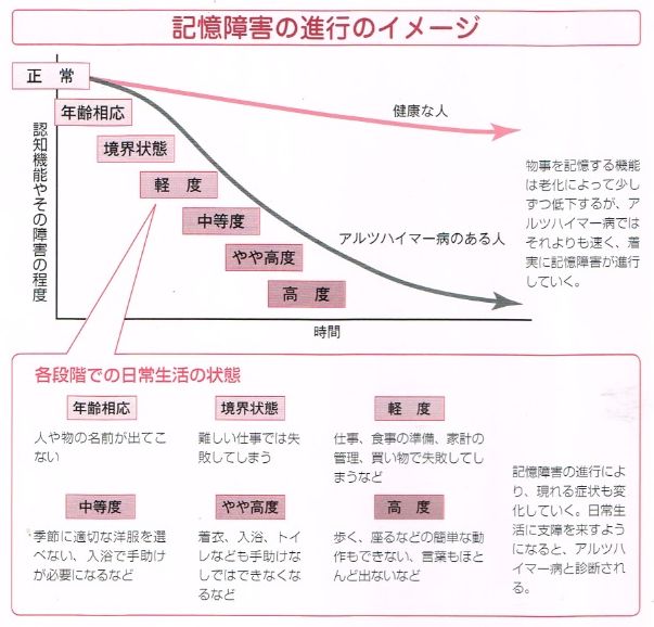 記憶障害の進行のイメージ