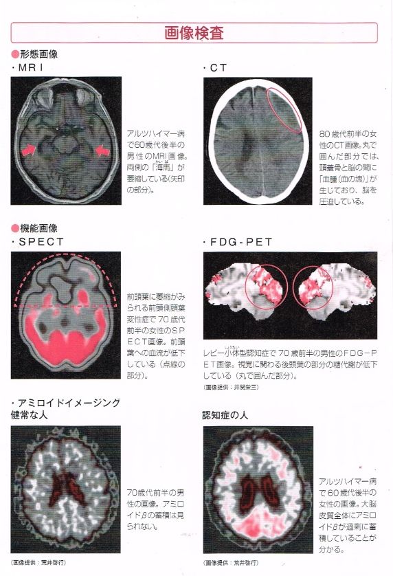 画像検査